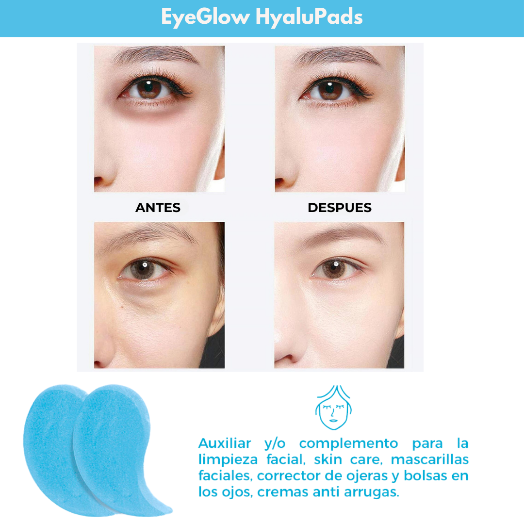 EyeGlow HyaluPads™ | 🤩 Parches para ojos con ácido hialurónico 💁‍♀️ | ¡Luce una mirada impecable!